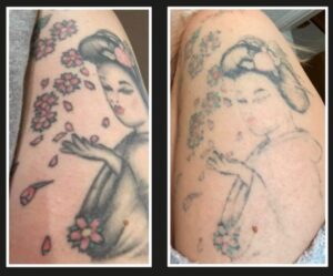 After 3 Sessions After 3 Sessions